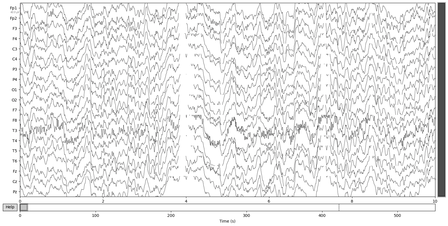 Brain activity recordings